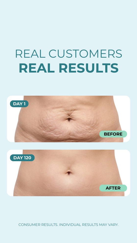 Smooth & Tight Belly Cream