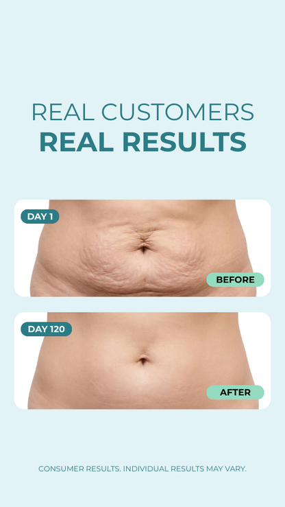 Smooth & Tight Belly Cream