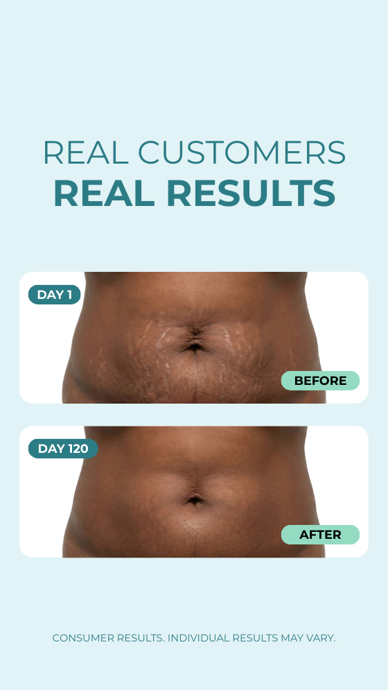 Smooth & Tight Belly Cream